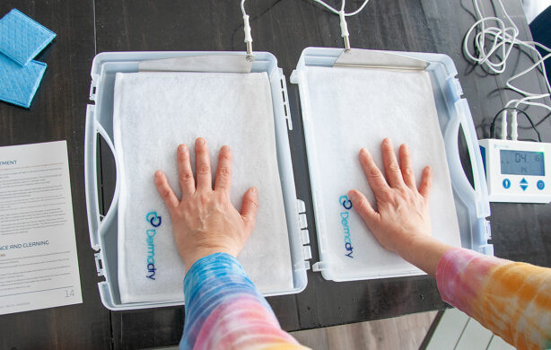 hands-in-dermadry-total-trays